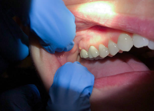 Best Emergency Dental Services for Seniors in Inman, SC