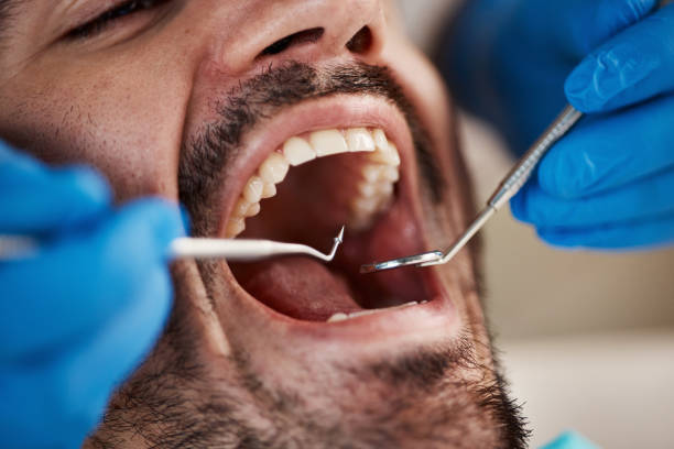 Best Broken or Cracked Tooth Emergency Dentist in Inman, SC