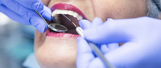 Best Emergency Dental Extractions in Inman, SC